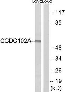 Western blot analysis of extracts from LOVO cells, using CCDC102A antibody.The lane on the right is treated with the synthesized peptide.