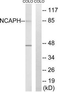 Western blot analysis of extracts from COLO cells, using NCAPH antibody.The lane on the right is treated with the synthesized peptide.