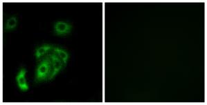 Immunofluorescence analysis of A549 cells, using CNTN5 antibody.The picture on the right is treated with the synthesized peptide.