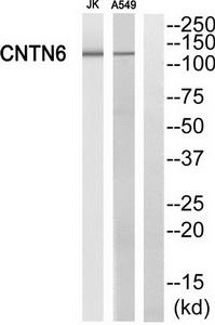 Western blot analysis of extracts from Jurkat cells and A549 cells, using CNTN6 antibody.The lane on the right is treated with the synthesized peptide.