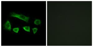 Immunofluorescence analysis of A549 cells, using NT5C1B antibody.The picture on the right is treated with the synthesized peptide.