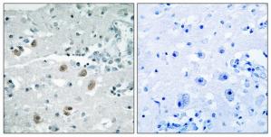 Immunohistochemistry analysis of paraffin-embedded human brain tissue using PLA2G4D antibody.The picture on the right is treated with the synthesized peptide.