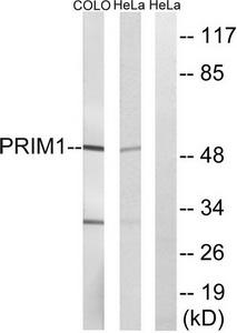 WB was performed on whole cell (25ug, lane 1) and histone extracts (15ug, lane 2 ) from HeLa cells, and on 1ug of recombinant histone H2A, H2B, H3 and H4 (lane 3, 4, 5 and 6, respectively) using the antibody against H3K18ac. The antibody was diluted 1:500 in TBS-Tween containing 5% skimmed milk. The marker (in kDa) is shown on the left.