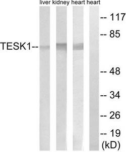 Western blot analysis of extracts from rat heart cells, rat kidney cells and rat liver cells, using TESK1 antibody.The lane on the right is treated with the synthesized peptide.