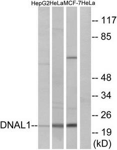 Western blot analysis of extracts from HepG2 cells, HeLa cells and MCF-7cells, using DNAL1 antibody.The lane on the right is treated with the synthesized peptide.