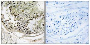 Immunohistochemistry analysis of paraffin-embedded human testis tissue using DYNLRB2 antibody.The picture on the right is treated with the synthesized peptide.