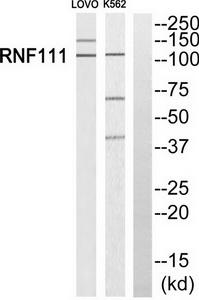 Western blot analysis of extracts from LOVO cells and K562 cells, using RNF111 antibody.The lane on the right is treated with the synthesized peptide.