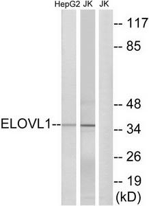 Western blot analysis of extracts from HepG2 cells and Jurkat cells, using ELOVL1 antibody.The lane on the right is treated with the synthesized peptide.