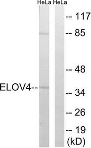 Western blot analysis of extracts from HeLa cells, using ELOVL4 antibody.The lane on the right is treated with the synthesized peptide.