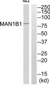Western blot analysis of extracts from 3T3 cells, using MAN1B1 antibody.The lane on the right is treated with the synthesized peptide.
