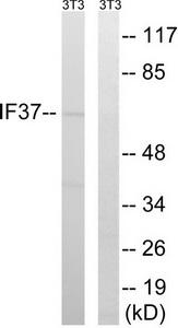 Western blot analysis of extracts from 3T3 cells, using EIF3D antibody.The lane on the right is treated with the synthesized peptide.