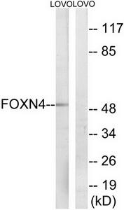 Western blot analysis of extracts from LOVO cells, using FOXN4 antibody.The lane on the right is treated with the synthesized peptide.