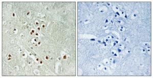 Immunohistochemistry analysis of paraffin-embedded human brain tissue using GADD45GIP1 antibody.The picture on the right is treated with the synthesized peptide.
