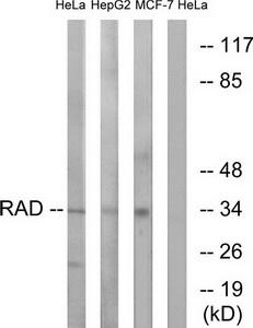 Western blot analysis of extracts from HeLa cells, HepG2 cells and MCF-7 cells, using RAD antibody.The lane on the right is treated with the synthesized peptide.