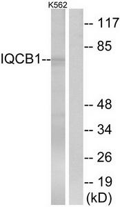 Western blot analysis of extracts from K562 cells, using IQCB1 antibody.The lane on the right is treated with the synthesized peptide.