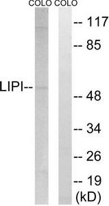 Western blot analysis of extracts from COLO cells, using LIPI antibody.The lane on the right is treated with the synthesized peptide.