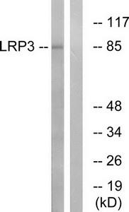 Western blot analysis of extracts from RAW264.7 cells, using LRP3 antibody.The lane on the right is treated with the synthesized peptide.