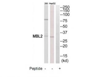 Western blot analysis of extracts from HepG2 cells and 293 cells, using MBL2 antibody.The lane on the right is treated with the synthesized peptide.