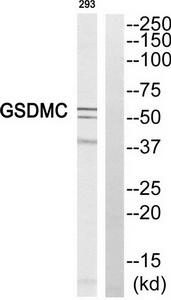 Western blot analysis of extracts from 293 cell, using GSDMC antibody.The lane on the right is treated with the synthesized peptide.