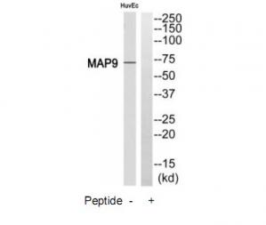 Western blot analysis of extracts from HuvEc cell, using MAP9 antibody.The lane on the right is treated with the synthesized peptide.