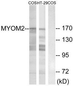 Western blot analysis of extracts from COS-7 cells and HT-29 cells, using MYOM2 antibody.The lane on the right is treated with the synthesized peptide.