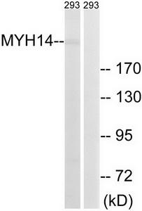 Western blot analysis of extracts from 293 cells, using MYH14 antibody.The lane on the right is treated with the synthesized peptide.