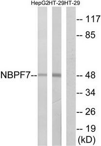 Western blot analysis of extracts from HepG2 cells and HT-29 cells, using NBPF7 antibody.The lane on the right is treated with the synthesized peptide.