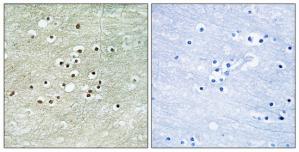 Immunohistochemistry analysis of paraffin-embedded human brain tissue using NPAS4 antibody.The picture on the right is treated with the synthesized peptide.