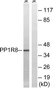 WB was performed on whole cell (25ug, lane 1) and histone extracts (15ug, lane 2 ) from HeLa cells, and on 1ug of recombinant histone H3 (lane 3) using the antibody against H3K79me1. The antibody was diluted 1:200 in TBS-Tween containing 5% skimmed milk. The position of the protein of interest is indicated on the right; the marker (in kDa) is shown on the left.