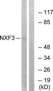 Western blot analysis of extracts from MCF-7 cells, using NXF3 antibody.The lane on the right is treated with the synthesized peptide.