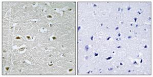 Immunohistochemistry analysis of paraffin-embedded human brain tissue using URB1 antibody.The picture on the right is treated with the synthesized peptide.