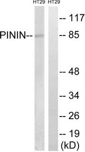 WB was performed using histone extracts from HeLa cells (HeLa HE, 15ug) and the antibody against H3K4me3 diluted 1:500 in TBS-Tween containing 5% skimmed milk. A molecular weight marker (in kDa) is shown on the left, the position of the protein of interest is shown on the right.