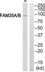 Western blot analysis of extracts from Jurkat cells, using FAM35A/B antibody.The lane on the right is treated with the synthesized peptide.