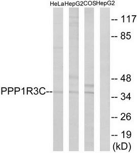 WB was performed on whole cell (25ug, lane 1) and histone extracts (15ug, lane 2 ) from HeLa cells, and on 1ug of recombinant histone H2A, H2B, H3 and H4 (lane 3, 4, 5 and 6, respectively) using the antibody against H3K27me3 diluted 1:500 in TBS-Tween containing 5% skimmed milk. The position of the protein of interest is indicated on the right; the marker (in kDa) is shown on the left.