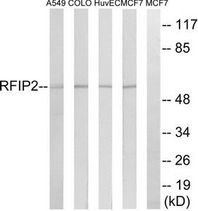 Western blot analysis of extracts from A549 cells, COLO cells, HUVEC cells and MCF-7 cells, using RAB11FIP2 antibody.The lane on the right is treated with the synthesized peptide.