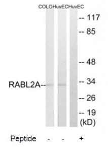 WB Suggested Anti-PTBP1 Antibody Titration: 0.2-1ug/ml; ELISA Titer: 1: 12500; Positive Control: Jurkat cell lysate; PTBP1 is strongly supported by BioGPS gene expression data to be expressed in Human Jurkat cells