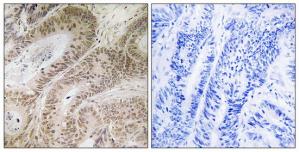 Immunohistochemistry analysis of paraffin-embedded human colon carcinoma tissue using RDM1 antibody.The picture on the right is treated with the synthesized peptide.