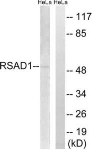 Western blot analysis of extracts from HeLa cells, using RSAD1 antibody.The lane on the right is treated with the synthesized peptide.