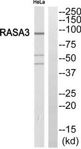 Western blot analysis of extracts from HeLa cells, using RASA3 antibody.The lane on the right is treated with the synthesized peptide.