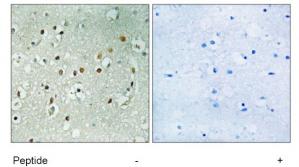 Immunohistochemistry analysis of paraffin-embedded human brain tissue using RPS6KL1 antibody.The picture on the right is treated with the synthesized peptide.