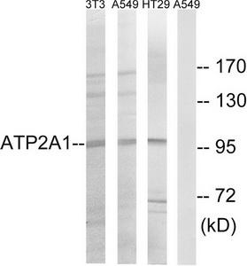 Western blot analysis of extracts from NIH/3T3 cells, A549 cells and HT-29 cells, using ATP2A1 antibody.The lane on the right is treated with the synthesized peptide.