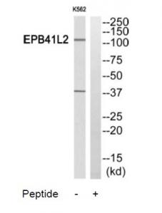 WB using the antibody against H3S10p diluted 1:1,000 in TBS-Tween containing 5% skimmed milk. The position of the protein of interest is indicated on the right; the marker (in kDa) is shown on the left.