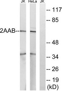 WB using the antibody against H3K36me1 diluted 1:1,000 in TBS-Tween containing 5% skimmed milk. The position of the protein of interest is indicated on the right; the marker (in kDa) is shown on the left.