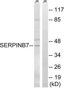 Western blot analysis of extracts from Jurkat cells, using SERPINB7 antibody.The lane on the right is treated with the synthesized peptide.