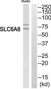 Western blot analysis of extracts from HuvEc cells, using SLC6A8 antibody.The lane on the right is treated with the synthesized peptide.