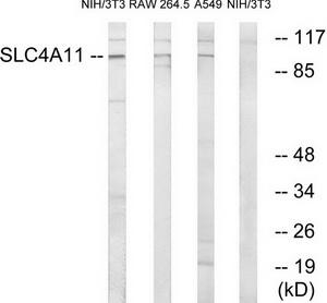 Western blot analysis of extracts from 3T3 cells, RAW264.7 cells and A549 cells, using SLC4A11 antibody.The lane on the right is treated with the synthesized peptide.