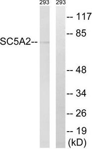 Western blot analysis of extracts from 293 cells, using SLC5A2 antibody.The lane on the right is treated with the synthesized peptide.