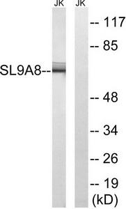 Western blot analysis of extracts from Jurkat cells, using SLC9A8 antibody.The lane on the right is treated with the synthesized peptide.
