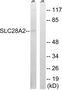 Western blot analysis of extracts from Jurkat cells, using SLC28A2 antibody.The lane on the right is treated with the synthesized peptide.