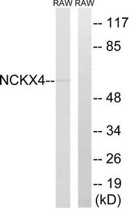 Western blot analysis of extracts from RAW264.7 cells, using SLC24A4 antibody.The lane on the right is treated with the synthesized peptide.